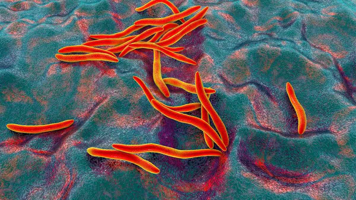 Univerzális bélmikrobiom-minta kapcsolódik a vastagbélrák felfedezéséhez