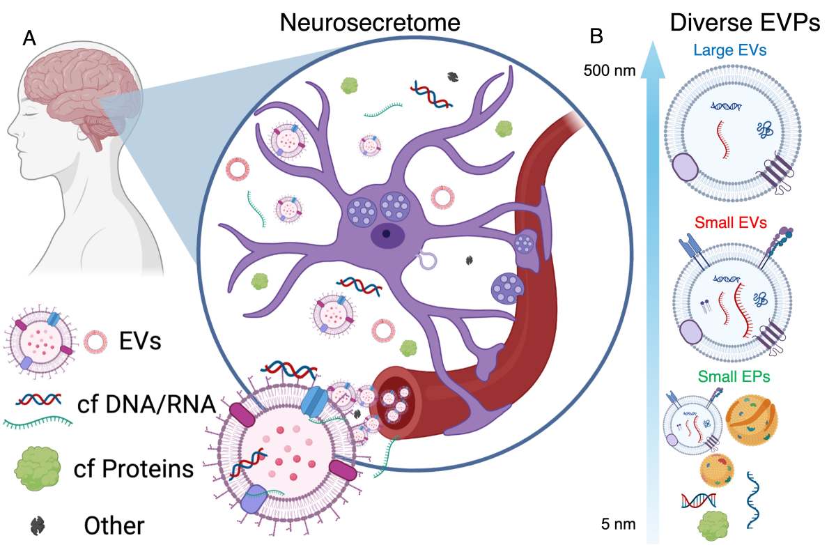RNS biomarkerek a vérben korábbi Alzheimer-kór kimutatását tehetik lehetővé