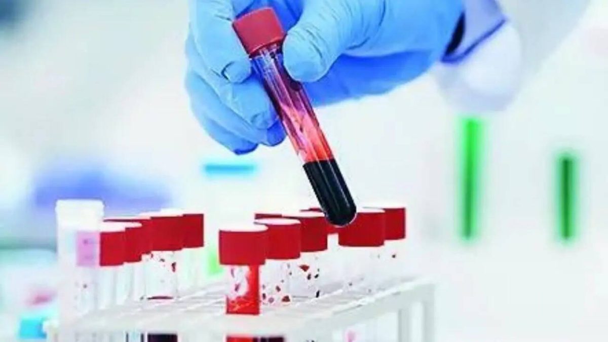 Vérvizsgálat előre jelezheti a tüdőrákot akár 5 évvel a diagnózis előtt