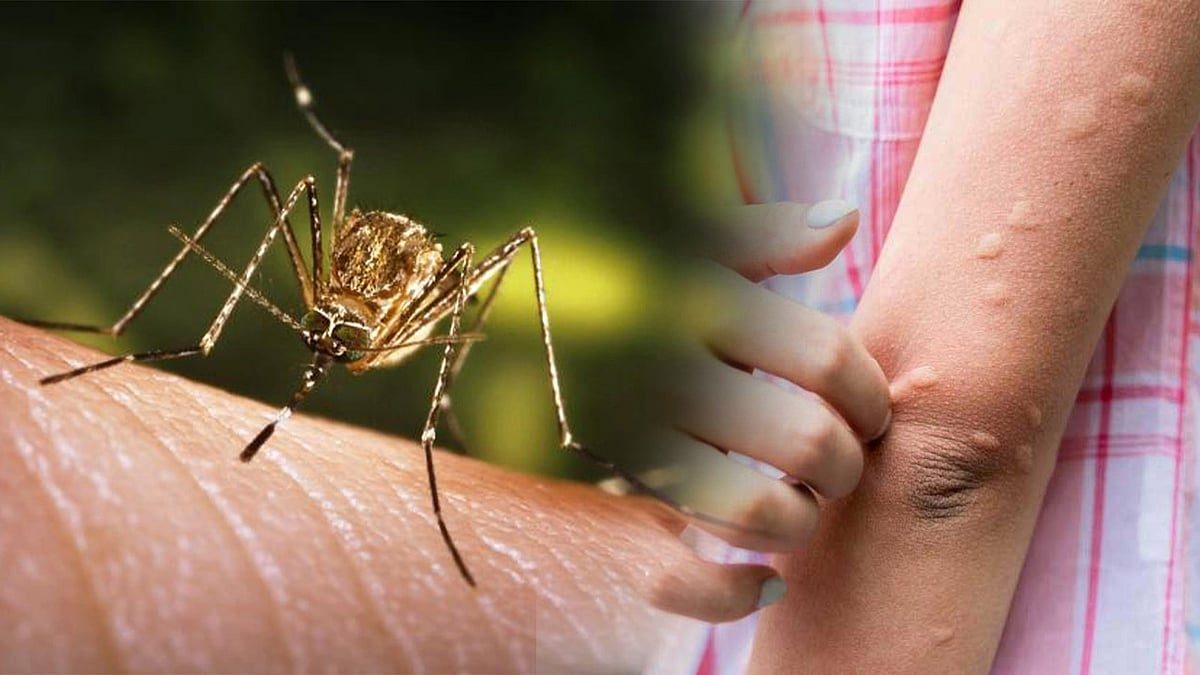 Sivasagar Egészségügyi Osztály fokozza a japán agyvelőgyulladás elleni védekezési erőfeszítéseket