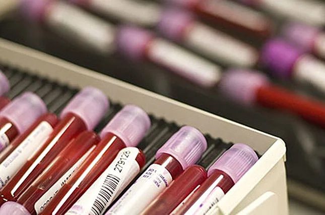 A cukorbetegség kezelése lassíthatja az Alzheimer-kórt? Tanulmány nyomon követ kulcsfontosságú biomarkert