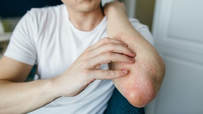 Száraz bőr vagy fájó lábak? Lehetséges vitaminhiány jelei
